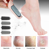 🦶✨ Premium Foot File – Callus Remover for Smooth, Soft Heels