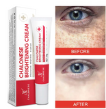 🌿✨ Chalonese Whitening Cream – Double Pack (Buy 1 Get 1 Free)