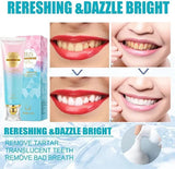 BodyAccel Niacinamide Whitening Toothpaste 🦷✨ – Brighten & Protect Your Smile